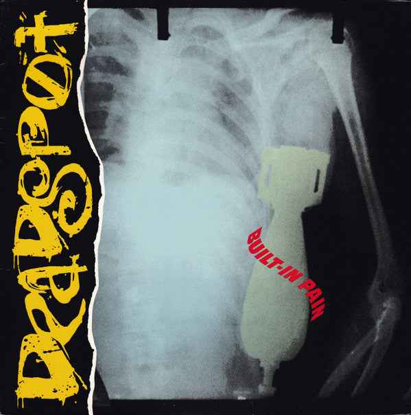 Deadspot - Built-In Pain (LP) (Near Mint (NM or M-))